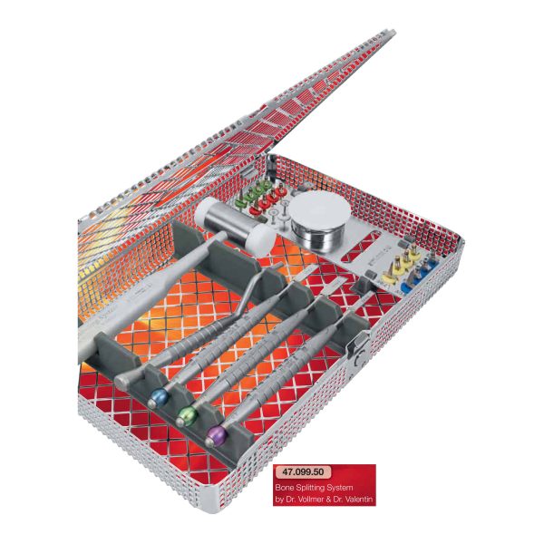 Bone Splitting System — Helmut Zepf