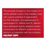 Bone Splitting System — Helmut Zepf